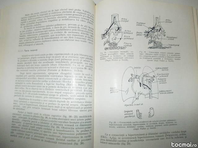 Carte Medicala Tromboembolismul Pulmonar